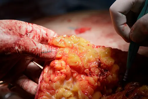 Traditional woodworking joinery